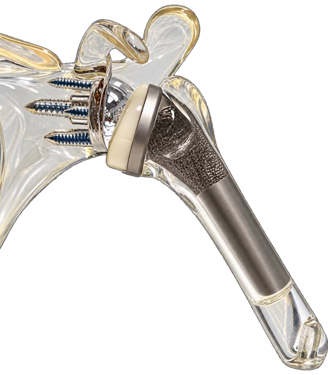 Reverse total shoulder replacement implant