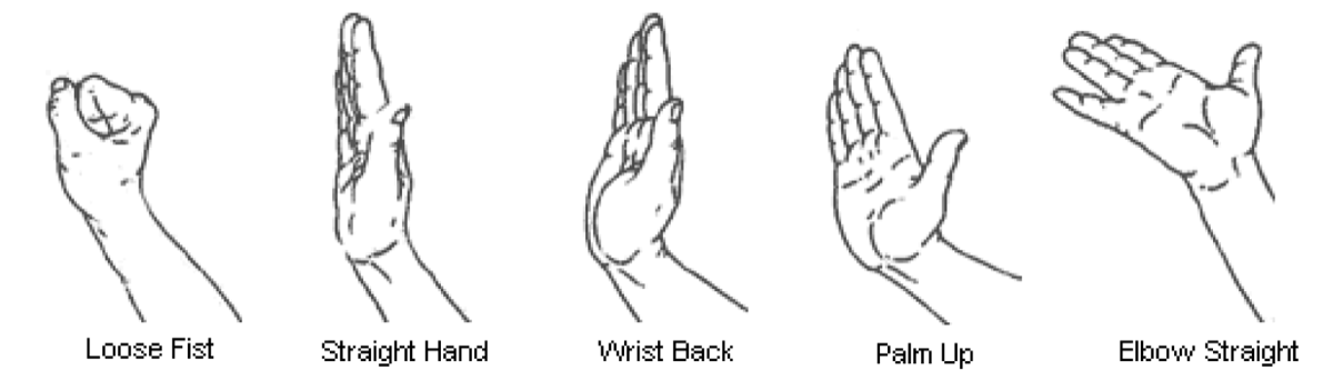 Median nerve gliding exercises: loose fist, straight hand, wrist back, palm up, elbow straight