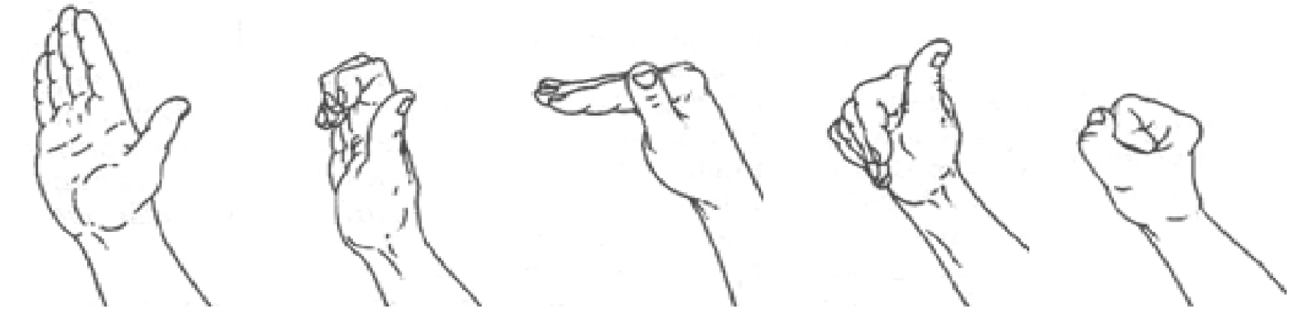Tendon gliding exercises: sequence of five hand positions from straight fingers through hook, tabletop and to a full fist
