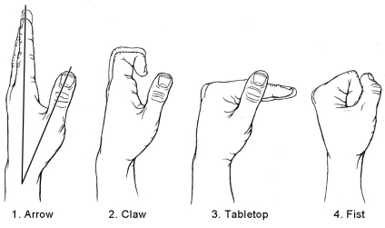 Finger exercises 1 to 4: arrow, claw, tabletop and fist hand positions